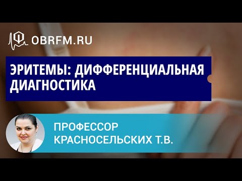 Видео: Профессор Красносельских Т.В.: Эритемы: дифференциальная диагностика