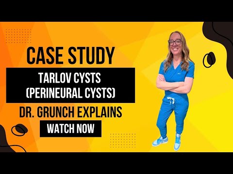 Видео: Клинический случай 139 | Кисты Тарлова или периневральные кисты | Объяснение нейрохирурга доктора...