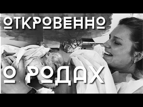 Видео: ИСТОРИЯ РОДОВ | 36 недель | Осложнения