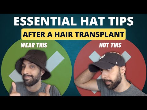 Видео: 7 важных советов по выбору шляпы ПОСЛЕ пересадки волос