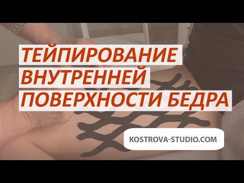 Видео: Тейпирование внутренней поверхности бедра