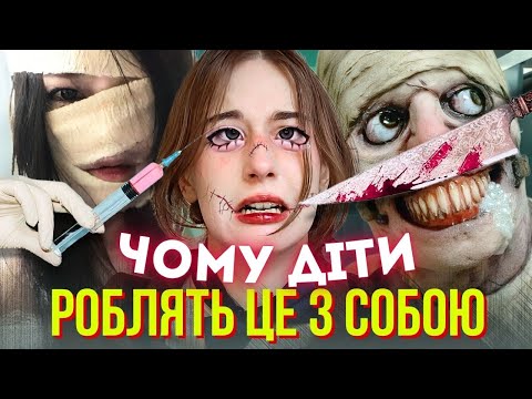 Видео: ЯК ПЛАСТИЧНА ХІРУРГІЯ ПЕРЕТВОРИЛАСЯ НА ПІДЛІТКОВИЙ ТРЕНД У TikTok (+ моя особиста історія СЕЛФXАRMУ)