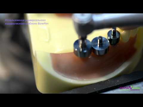 Видео: Использование шаблона BonePen