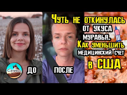 Видео: Чуть не откинулась от укуса муравья / Дикая природа на юге США / Как уменьшить медицинский счёт?