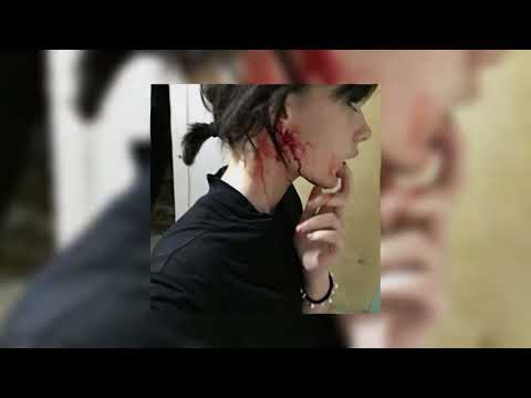 Видео: booker, юг 404 - шрамы ♡speed up♡