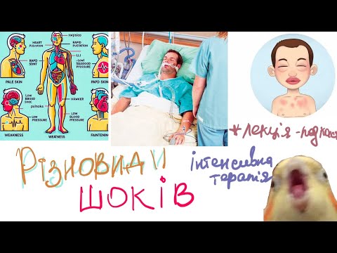 Видео: Шок : різновиди, еітопатогенез, клініка, інтенсивна терапія (лекція-подкаст)