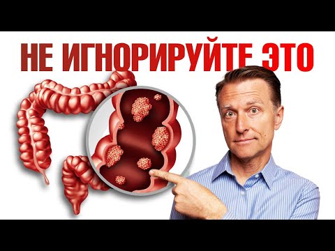 Видео: 6 ранних признаков рака толстой кишки. НЕ ПРОПУСТИ🧐