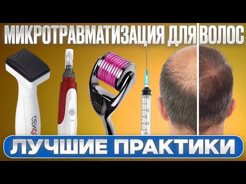 Видео: Восстановление волос методом микротравматизации БЕЗ ОШИБОК!