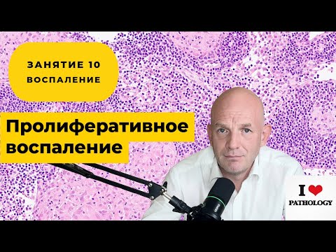 Видео: Пролиферативное воспаление - краткий обзор занятия №10