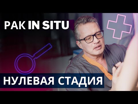 Видео: Рак in situ или нулевая стадия рака | Особенности диагноза и лечения