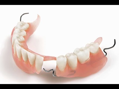 Видео: Как делают акриловые зубные протезы