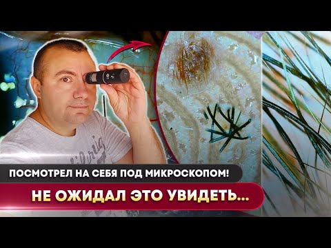 Видео: Что живёт на коже человека? Проверил себя под микроскопом — волосы, пот, родинки и борода