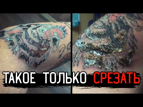 Видео: Заживление ТАТУ ПЛЕНКОЙ НЕ СРАБОТАЛО. Последствия лазера | ТАТУ ПОРТЯТ ЖИЗНЬ