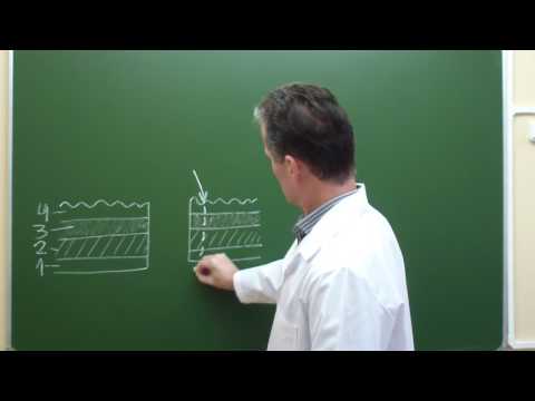 Видео: Схема непрерывного обвивного шва на заднюю губу межкишечного анастомоза