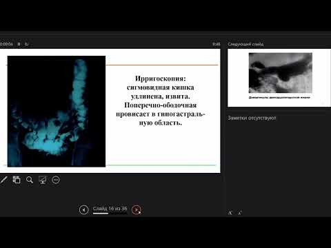 Видео: Стяжкина С.Н. Новые технологии в диагностике и лечении язвенного колита и болезни Крона. 26.10.2023