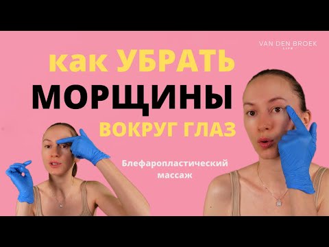 Видео: УБРАТЬ МОРЩИНЫ ВОКРУГ ГЛАЗ | Блефаропластический массаж