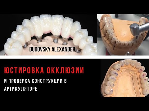 Видео: Тотал! Избирательное пришлифовывание прототипов коронок - юстировка окклюзии в артикуляторе