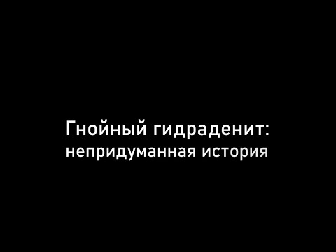 Видео: #Гнойный гидраденит Лечение, жизнь и я.