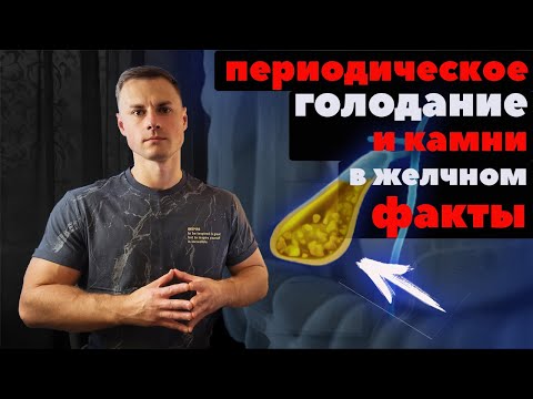 Видео: Периодическое голодание и камни в желчном. Факты!