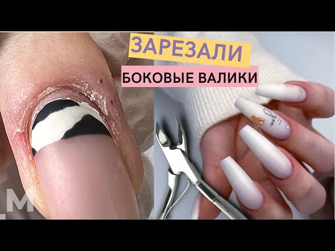 Видео: ИСКРОМСАЛИ КУСАЧКАМИ 😖 Сложный маникюр. ПОВРЕЖДЕННАЯ кожа. Наращивание ногтей БАЛЕРИНА💅