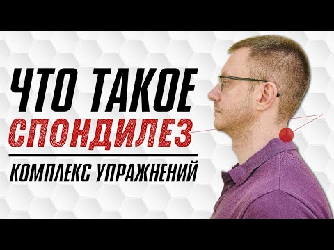 Видео: СПОНДИЛЕЗ. БОЛИТ ШЕЯ. Причины и профилактика. Топ 5 Упражнений при Спондилезе.