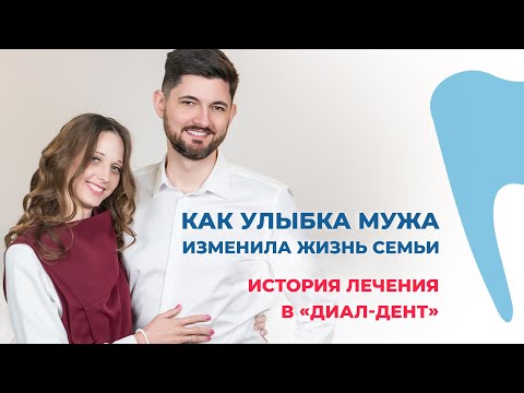 Видео: Как улыбка мужа изменила жизнь всей семьи! История лечения в «Диал-Дент»