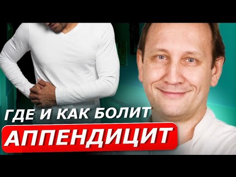 Видео: Где болит аппендицит и как его заподозрить | ОТВЕТЫ ВРАЧА-ХИРУРГА