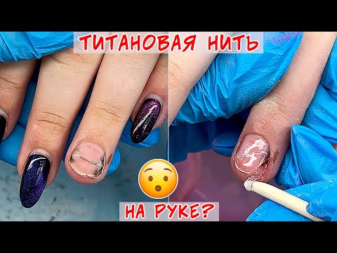 Видео: После установки титановой нити на ноготь / Протезирование ногтей на руках