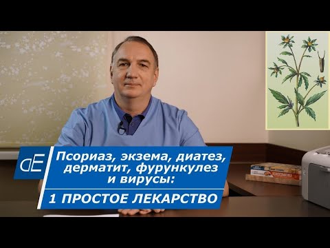 Видео: Псориаз, ЭКЗЕМА, диатез, ДЕРМАТИТ, простуда и ВИРУСЫ = 1 простое лечение. Череда, её применение.