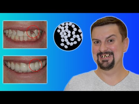 Видео: Новинка  -  круче чем китайские СЪЕМНЫЕ ВИНИРЫ для зубов Тестирую товары с joom ПРОВЕРКА РЕКЛАМЫ