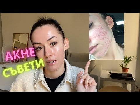 Видео: АКНЕ | За акнето и колко важна е основната грижа за кожата - Част 1 #SkincareEducationbyBewell