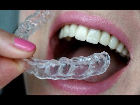 Видео: Капа от хруста челюсти. Мои впечатления!