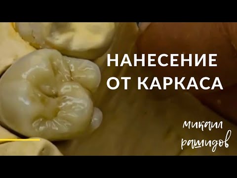 Видео: Нанесение керамики от каркаса . Резец и моляр