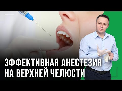 Видео: Анестезия на верхней челюсти