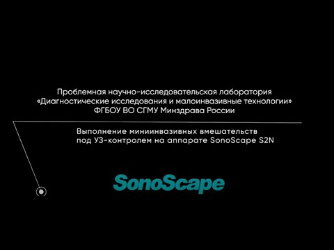 Видео: Выполнение миниинвазивных вмешательств под УЗ-контролем на аппарате SonoScape S2N