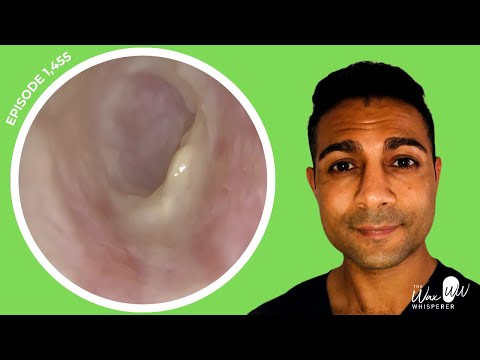 Видео: 1455 — Пациент с наружным отитом, не поддающийся лечению пероральными антибиотиками, обратился за...