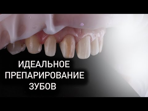 Видео: СЕКРЕТ идеального препарирования зубов!