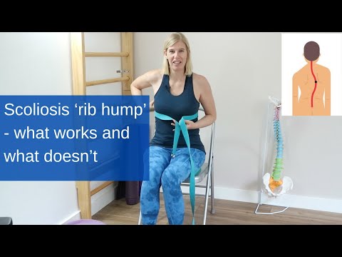 Видео: Как уменьшить сколиозный реберный горб (благоприятно для спондилодеза)