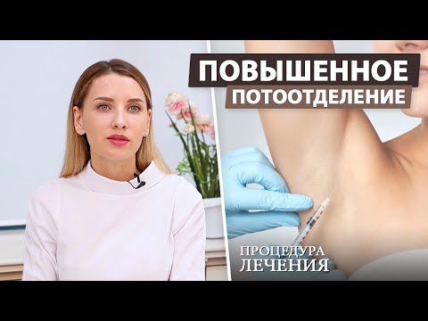 Видео: Процедура лечения гипергидроза (повышенное потоотделение)