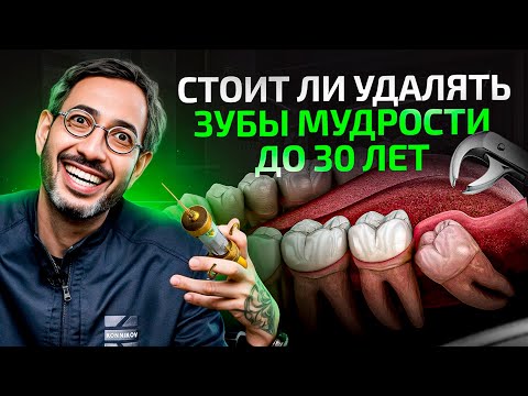 Видео: 5 причин удалить зубы мудрости до 30 лет. Они тебе пригодятся только в 2 случаях