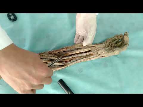 Видео: мышцы 5   Білек бұлшықеттері