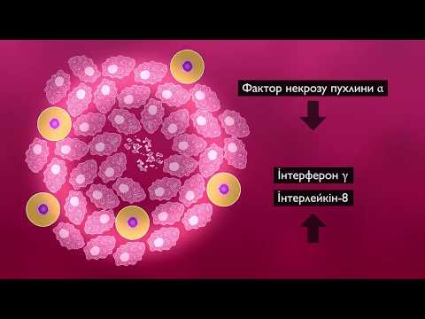 Видео: Латентна туберкульозна інфекція і туберкульоз (тема №1)