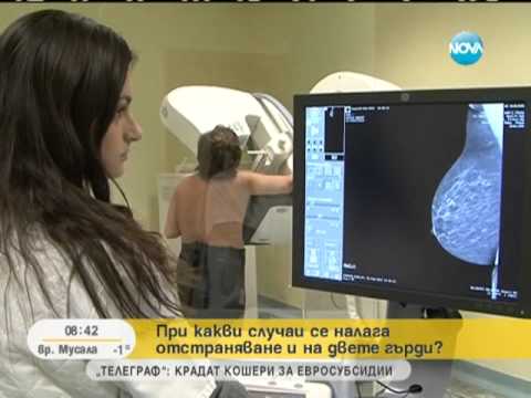 Видео: Мастектомията -- начин за предпазване от рак на гърдата