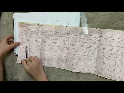 Видео: ЭКГ ҚАЗАҚША!!!