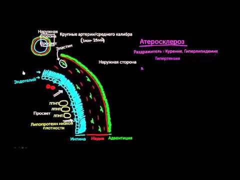 Видео: Атеросклероз, часть 1