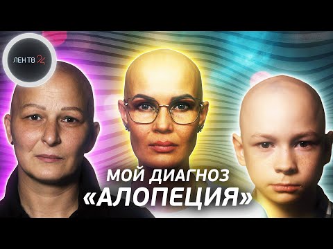 Видео: Что такое АЛОПЕЦИЯ? | Истории людей о жизни без волос | Страна лысых