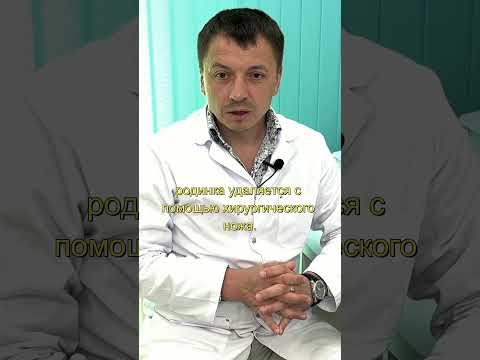 Видео: КАК СЕЙЧАС УДАЛЯЮТ РОДИНКИ? - Саквояж Здоровья ®