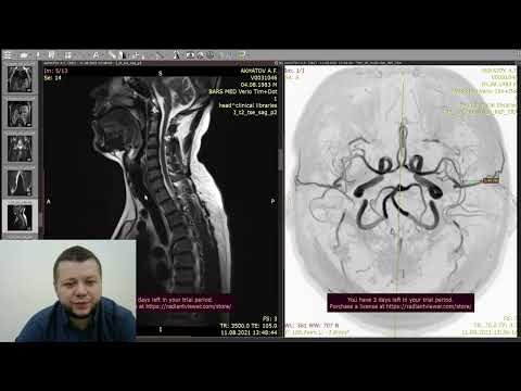 Видео: МРТ CHECK-UP всего тела! Что в него входит?