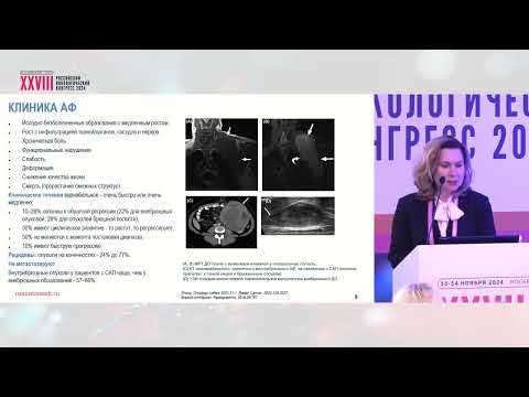 Видео: Агрессивный фиброматоз