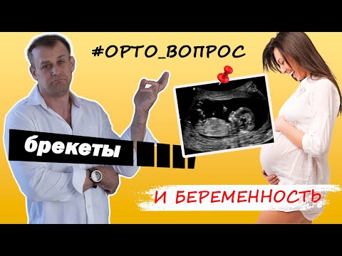 Видео: Брекеты во время беременности: можно?